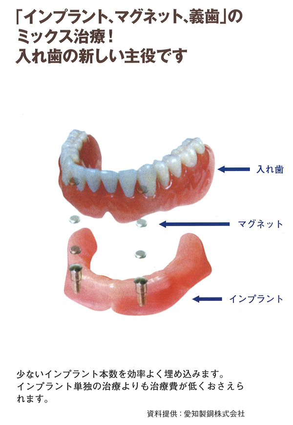 入れ歯 義歯の種類 入れ歯 総入れ歯 部分入れ歯専門の歯医者なら東京あさひクリニック歯科